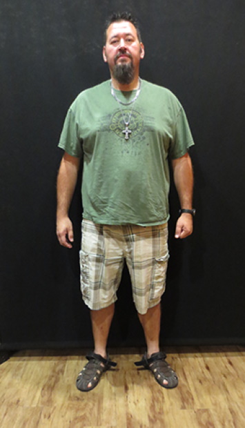 Rich B. after weight loss program results